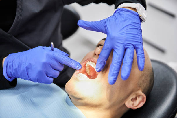 Best Emergency Dentist for Lost Fillings or Crowns in Pelahatchie, MS